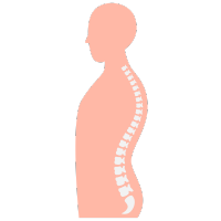 Hernia de Disco Hernia de Disco tabasco