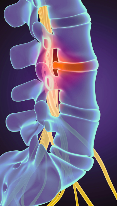 especialista en cirugia de columna villahermosa
