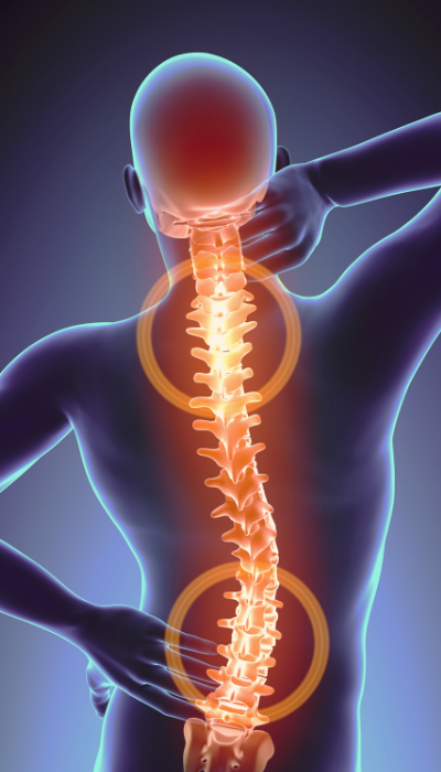 especialista en cirugia de columna vertebral villahermosa